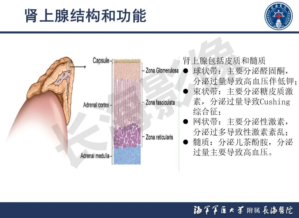 影像PPT - 【PPT】肾上腺占位影像诊断-5