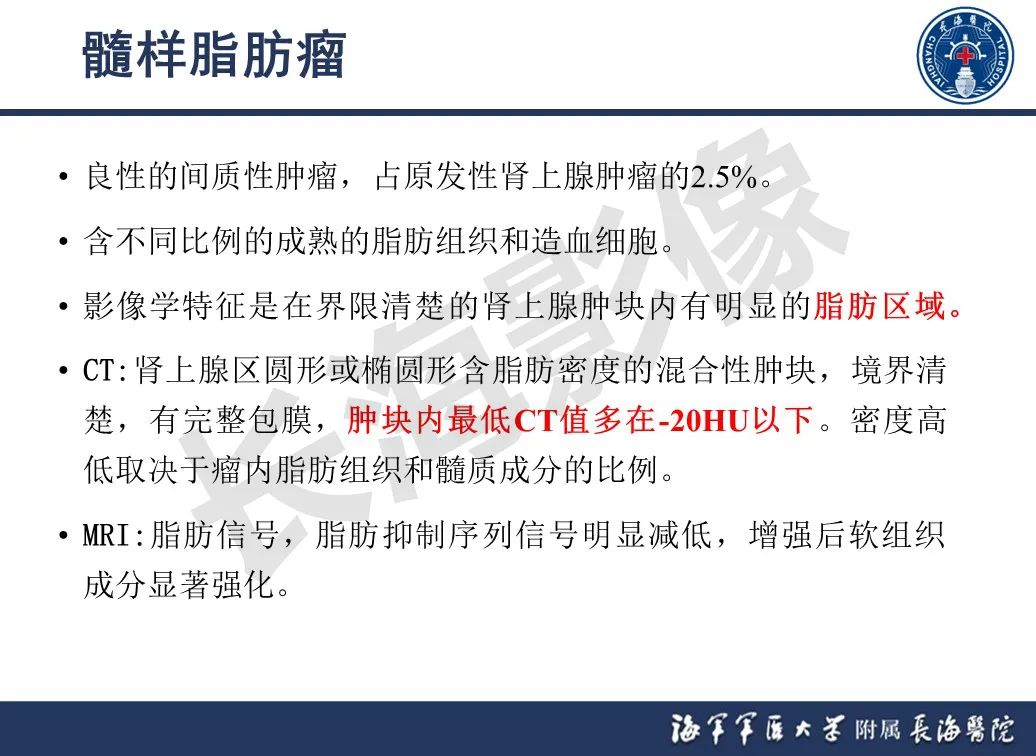 影像PPT - 【PPT】肾上腺占位影像诊断-13