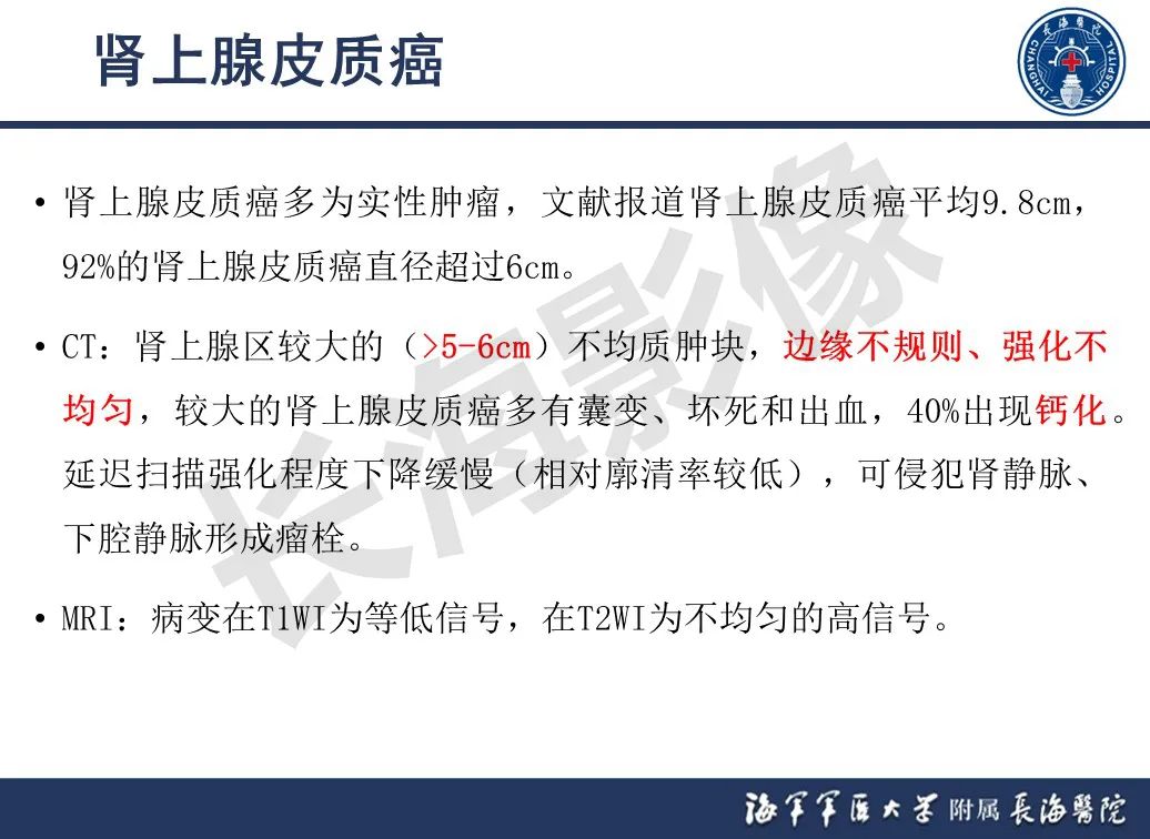 影像PPT - 【PPT】肾上腺占位影像诊断-24