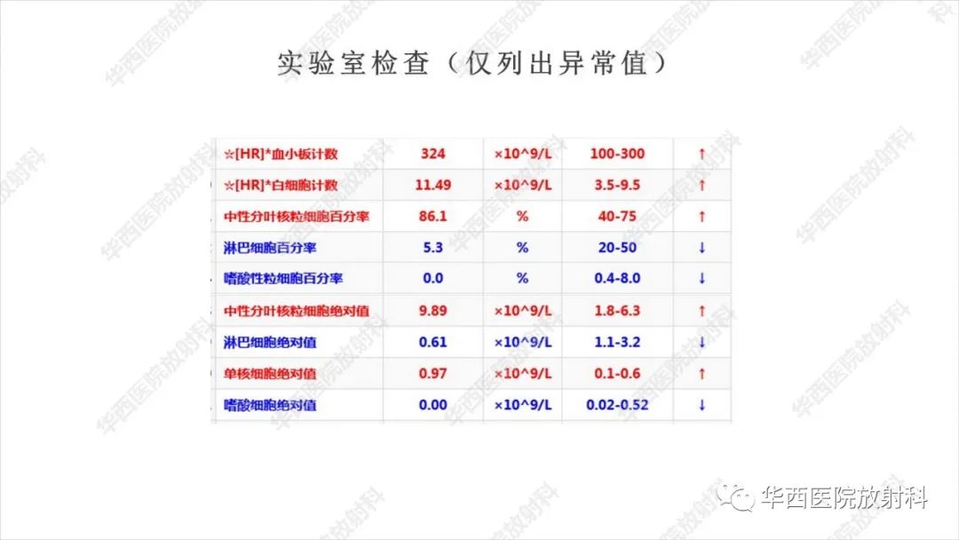 影像PPT - 【病例】阑尾淋巴瘤1例CT及MR影像诊断-3