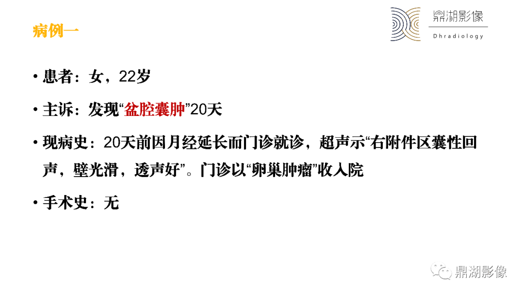 影像PPT - 【PPT】卵巢囊腺瘤/癌诊断及鉴别-5