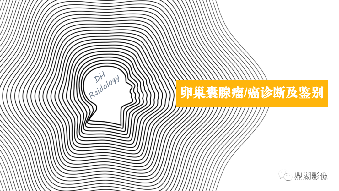 影像PPT - 【PPT】卵巢囊腺瘤/癌诊断及鉴别-1