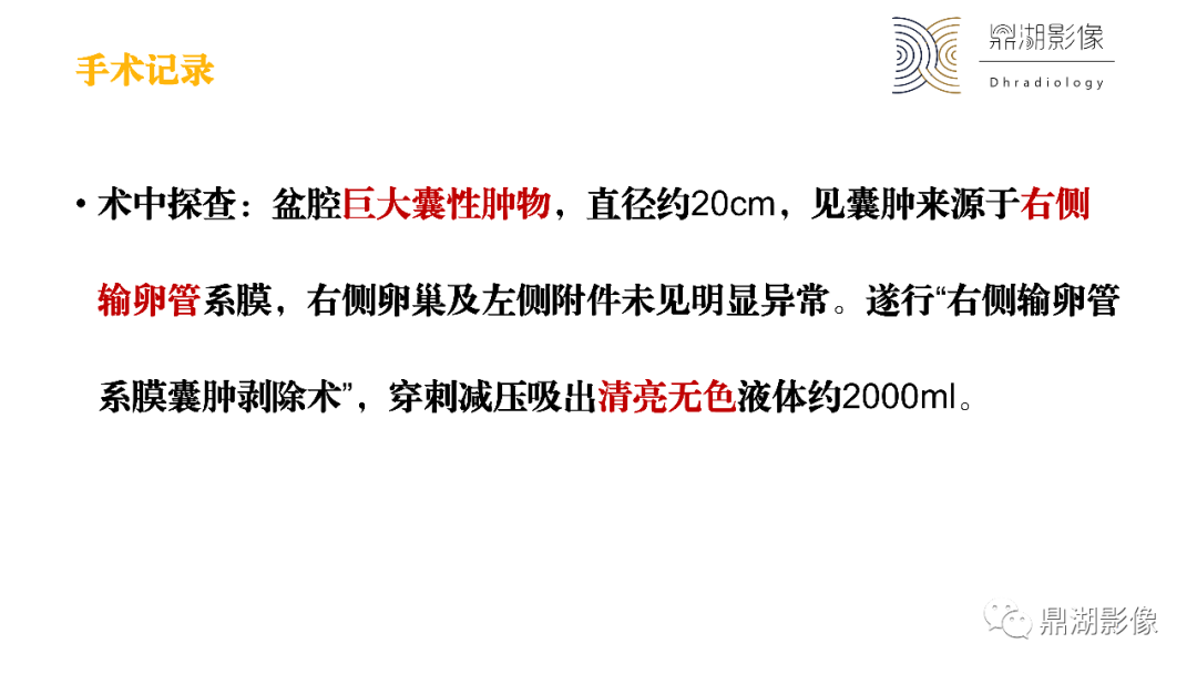 影像PPT - 【PPT】卵巢囊腺瘤/癌诊断及鉴别-7