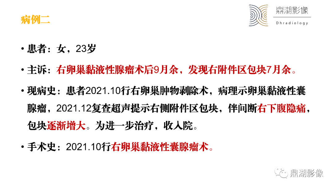 影像PPT - 【PPT】卵巢囊腺瘤/癌诊断及鉴别-9