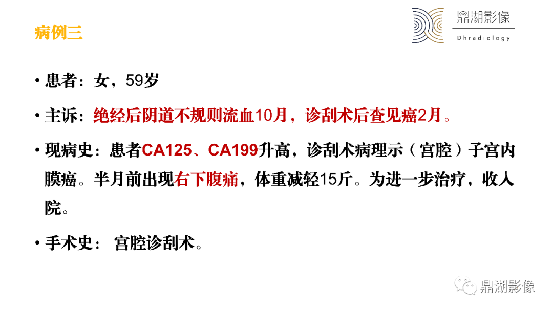 影像PPT - 【PPT】卵巢囊腺瘤/癌诊断及鉴别-13