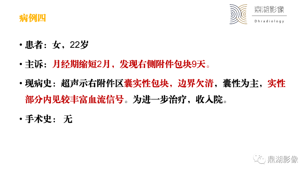 影像PPT - 【PPT】卵巢囊腺瘤/癌诊断及鉴别-17