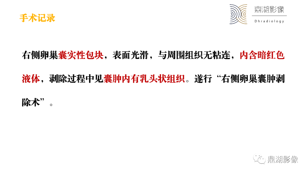 影像PPT - 【PPT】卵巢囊腺瘤/癌诊断及鉴别-19