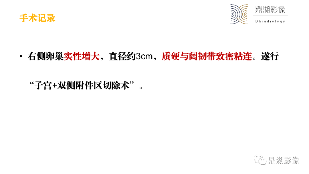 影像PPT - 【PPT】卵巢囊腺瘤/癌诊断及鉴别-15