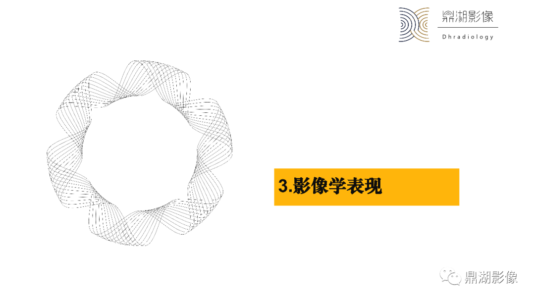 影像PPT - 【PPT】卵巢囊腺瘤/癌诊断及鉴别-29