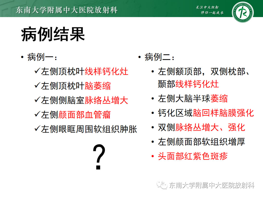 影像PPT - 【PPT】Sturge-Weber综合征-7 影像PPT - 【PPT】Sturge-Weber综合征-7
