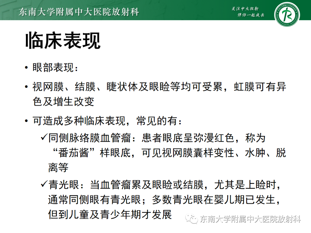 影像PPT - 【PPT】Sturge-Weber综合征-15 影像PPT - 【PPT】Sturge-Weber综合征-15