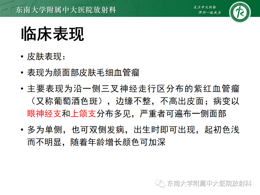 影像PPT - 【PPT】Sturge-Weber综合征-12 影像PPT - 【PPT】Sturge-Weber综合征-12