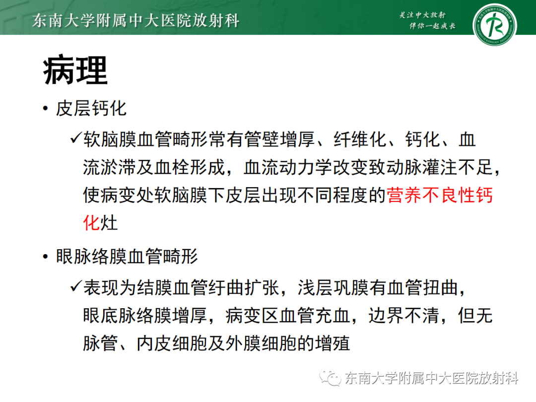 影像PPT - 【PPT】Sturge-Weber综合征-18 影像PPT - 【PPT】Sturge-Weber综合征-18