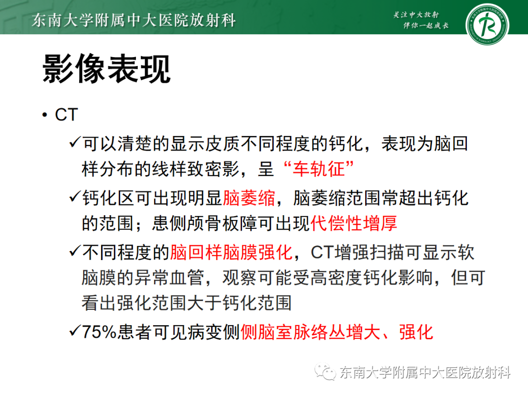 影像PPT - 【PPT】Sturge-Weber综合征-19 影像PPT - 【PPT】Sturge-Weber综合征-19