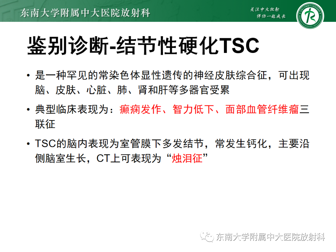 影像PPT - 【PPT】Sturge-Weber综合征-28 影像PPT - 【PPT】Sturge-Weber综合征-28