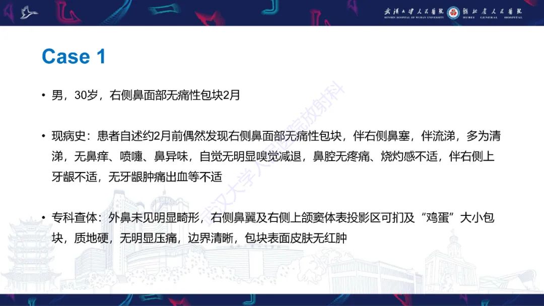 影像PPT - 【PPT】成釉细胞瘤影像诊断-2