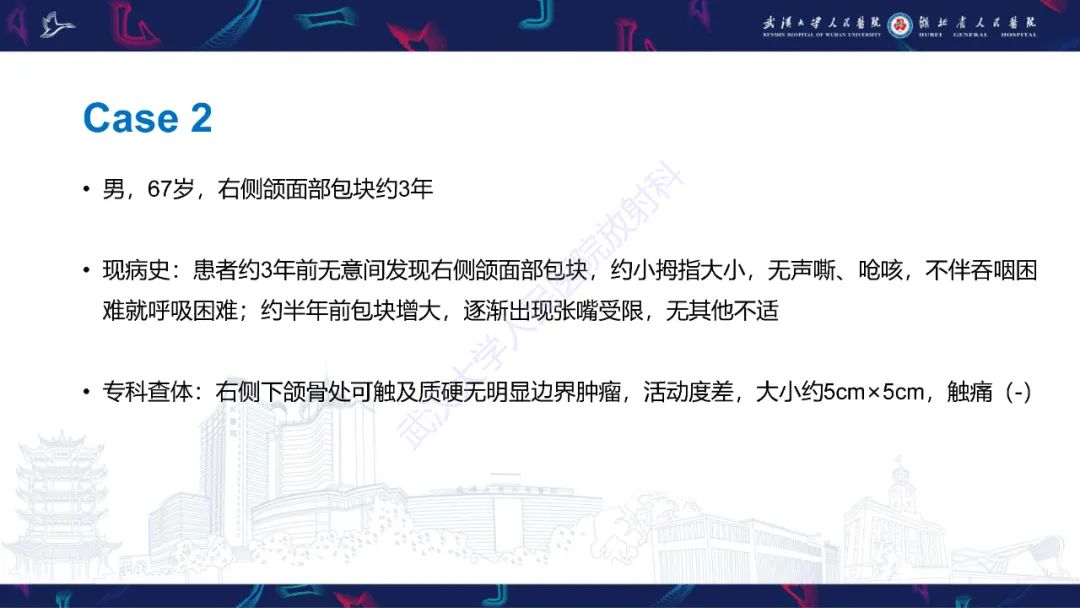 影像PPT - 【PPT】成釉细胞瘤影像诊断-5
