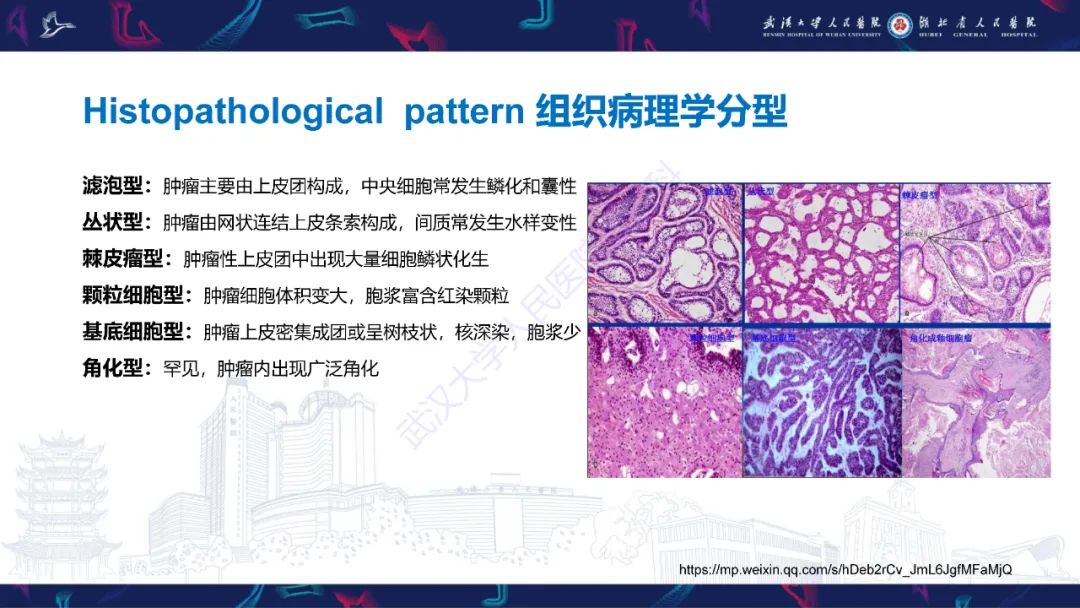 影像PPT - 【PPT】成釉细胞瘤影像诊断-13
