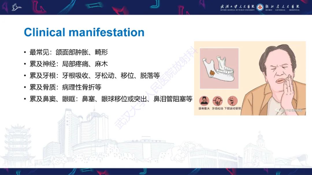 影像PPT - 【PPT】成釉细胞瘤影像诊断-16