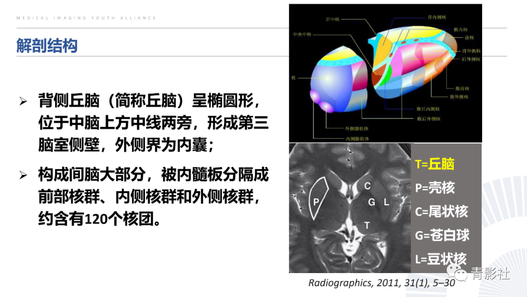 影像PPT - 【PPT】丘脑解剖及常见病变的影像学诊断-2