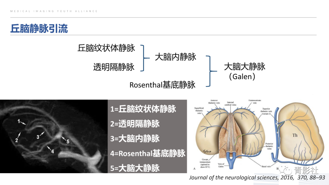 影像PPT - 【PPT】丘脑解剖及常见病变的影像学诊断-4