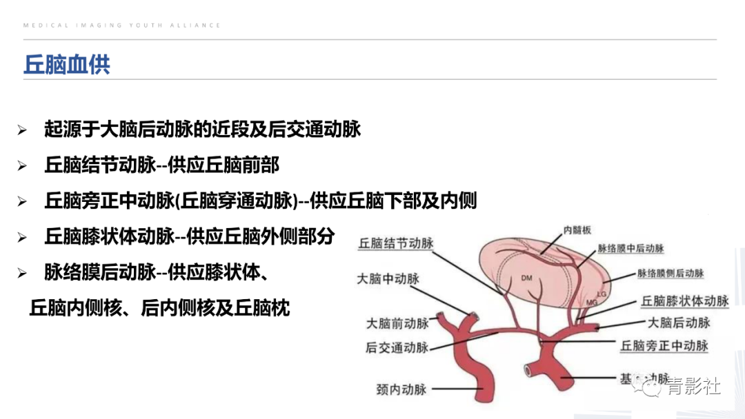 影像PPT - 【PPT】丘脑解剖及常见病变的影像学诊断-3