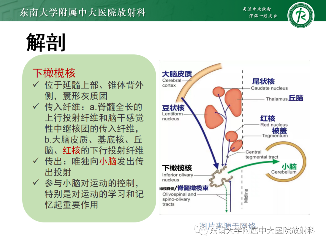 影像PPT - 【PPT】肥大性下橄榄核变性-6