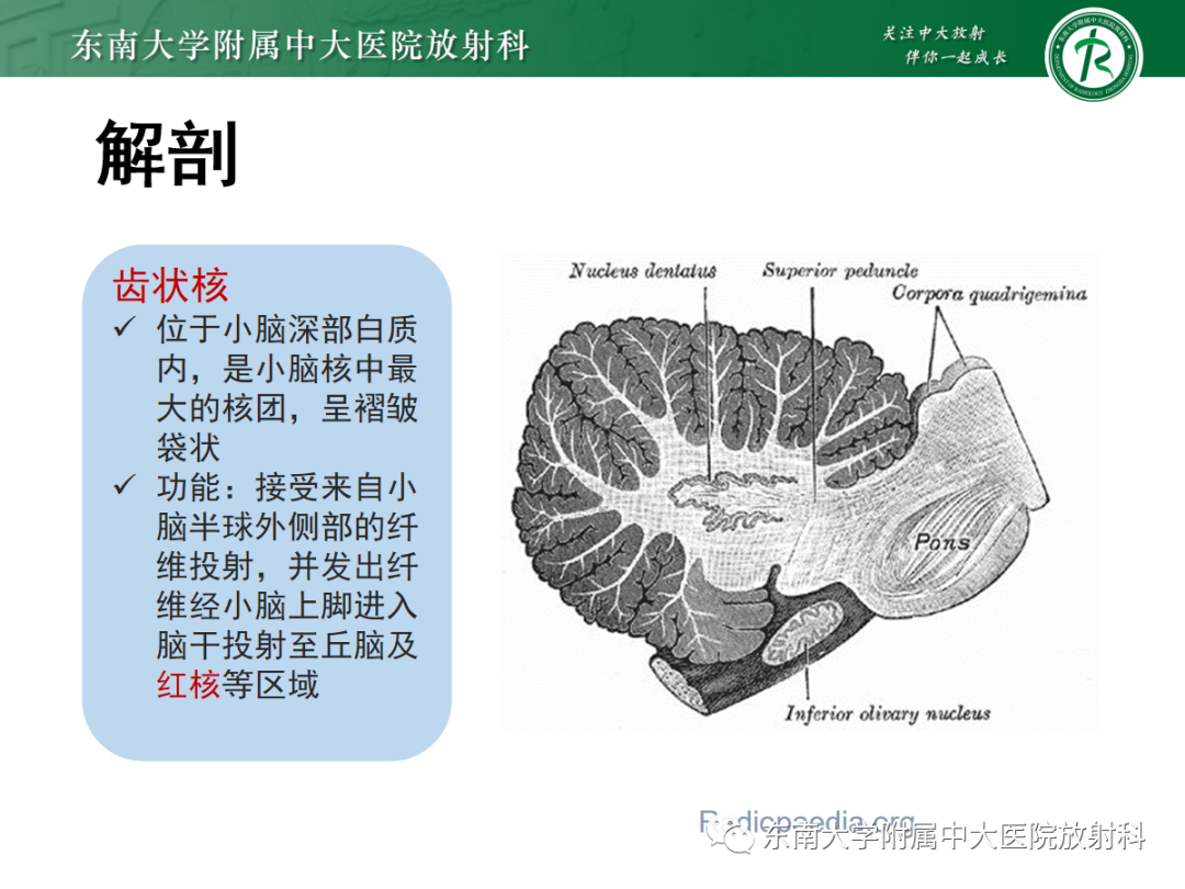 影像PPT - 【PPT】肥大性下橄榄核变性-10
