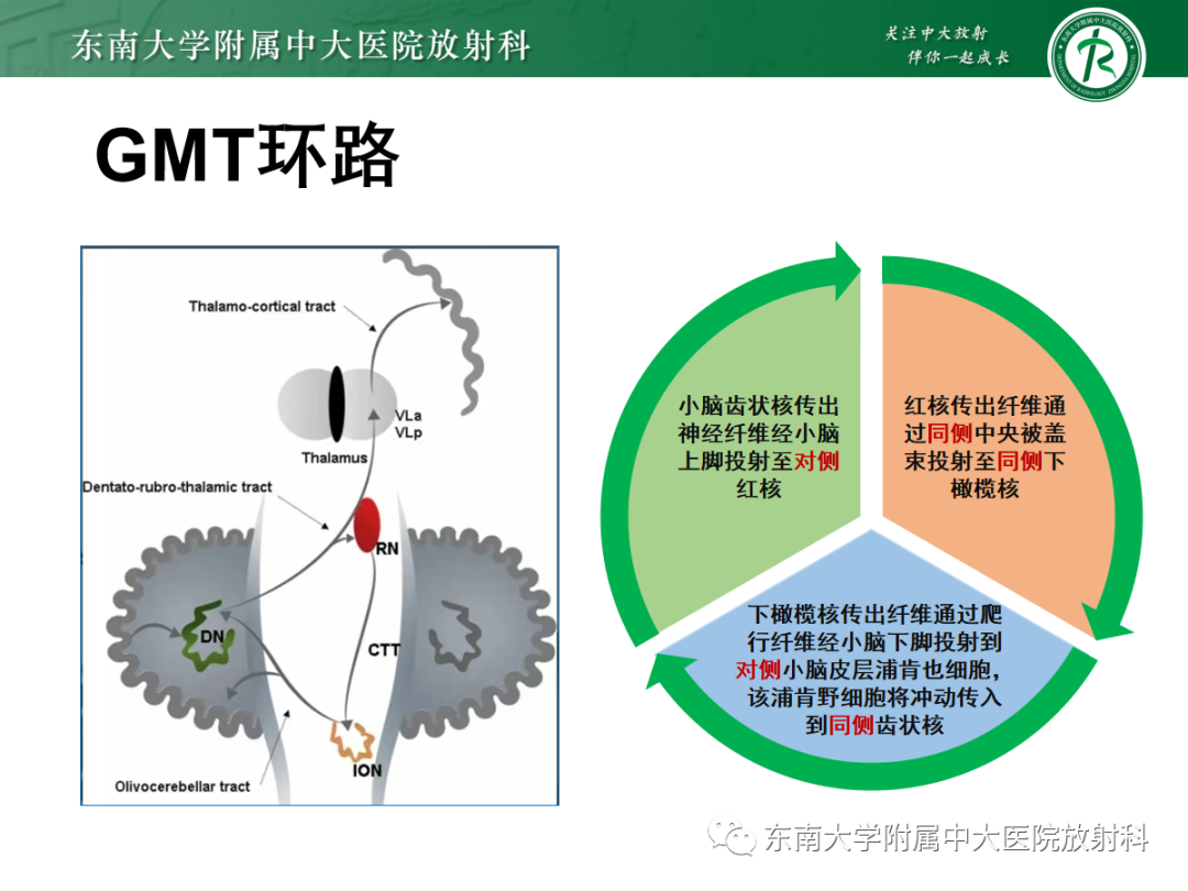 影像PPT - 【PPT】肥大性下橄榄核变性-15