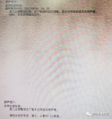 影像PPT - 【病例】血源性金黄色葡萄球菌性肺炎1例CT影像-25 影像PPT - 【病例】血源性金黄色葡萄球菌性肺炎1例CT影像-25