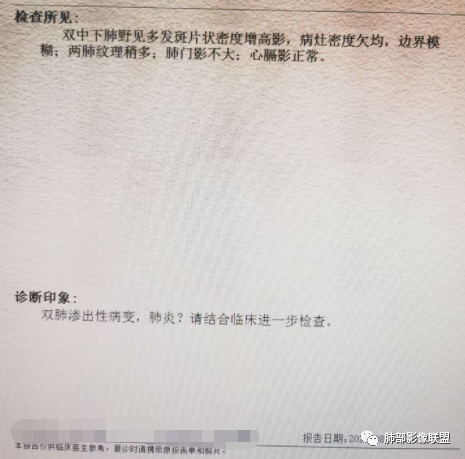 影像PPT - 【病例】血源性金黄色葡萄球菌性肺炎1例CT影像-27 影像PPT - 【病例】血源性金黄色葡萄球菌性肺炎1例CT影像-27