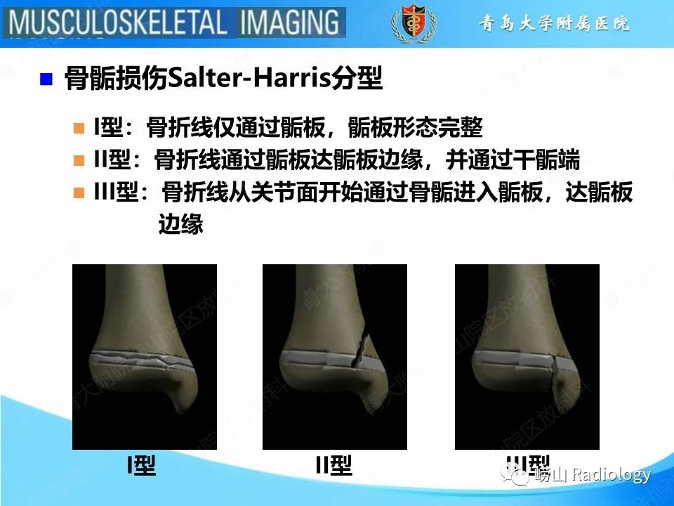 影像PPT - 【PPT】索尔特骨折-5