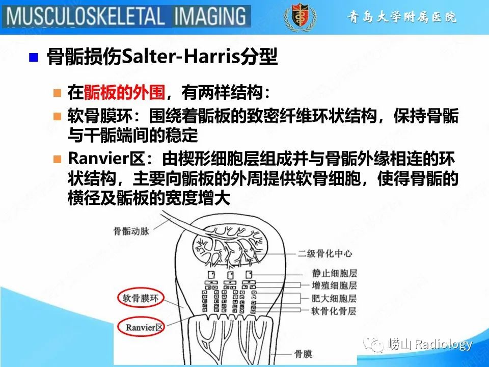 影像PPT - 【PPT】索尔特骨折-7