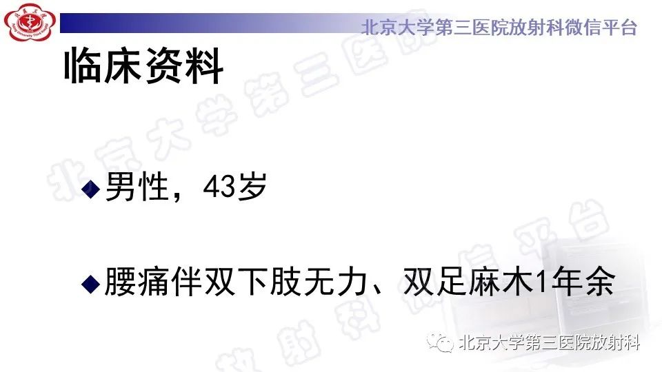 影像PPT - 【PPT】椎管内脊膜囊肿-2