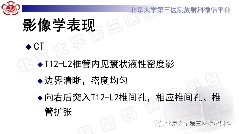 影像PPT - 【PPT】椎管内脊膜囊肿-10