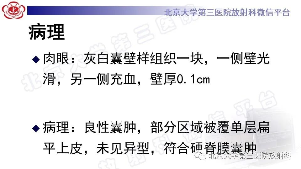 影像PPT - 【PPT】椎管内脊膜囊肿-13