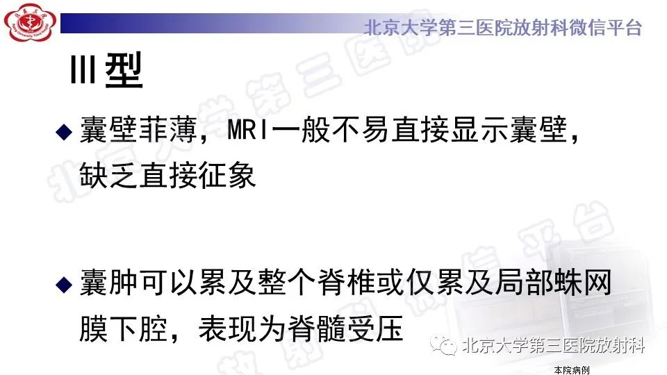 影像PPT - 【PPT】椎管内脊膜囊肿-32
