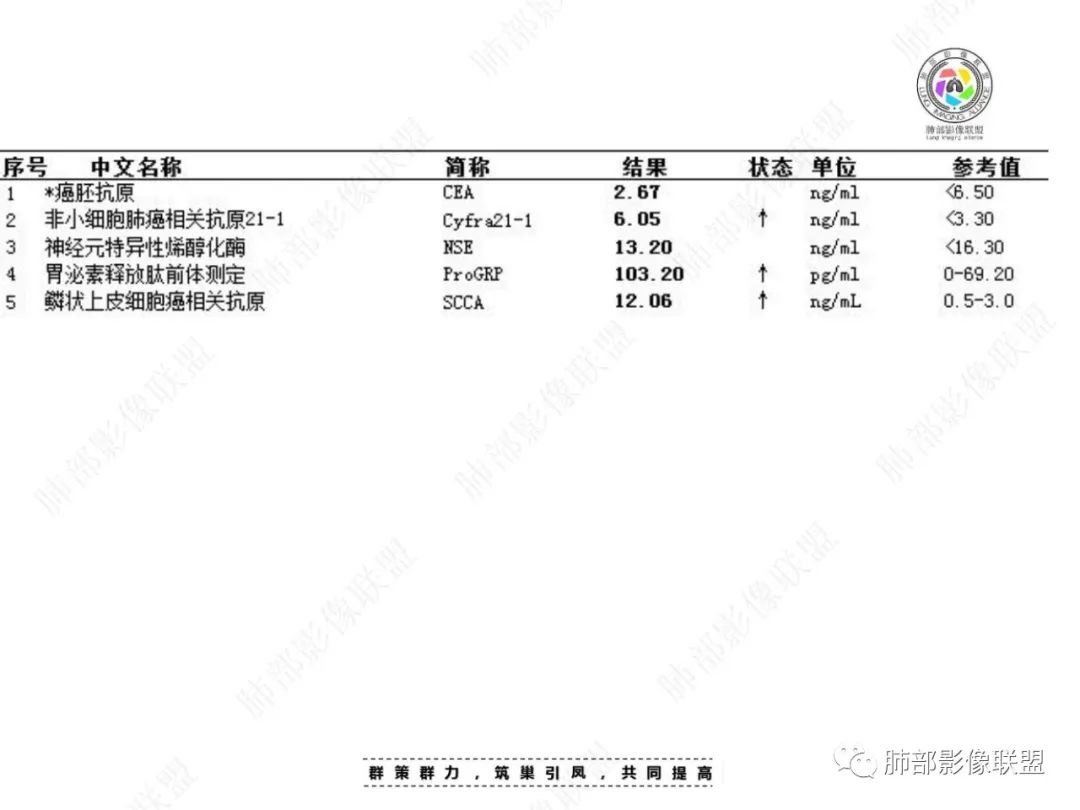 影像PPT - 【病例】外周胸膜下类圆形肿块—鳞癌与肉瘤样癌的纠结-3 影像PPT - 【病例】外周胸膜下类圆形肿块—鳞癌与肉瘤样癌的纠结-3