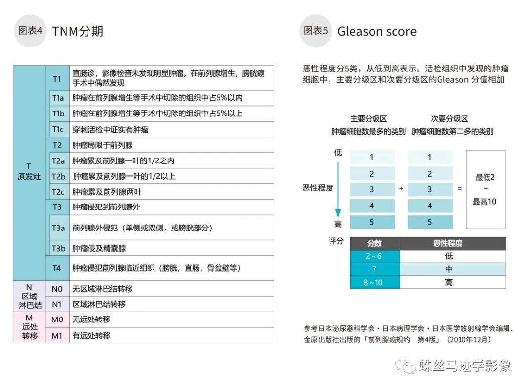 影像PPT - 常见肿瘤的TNM分期-14