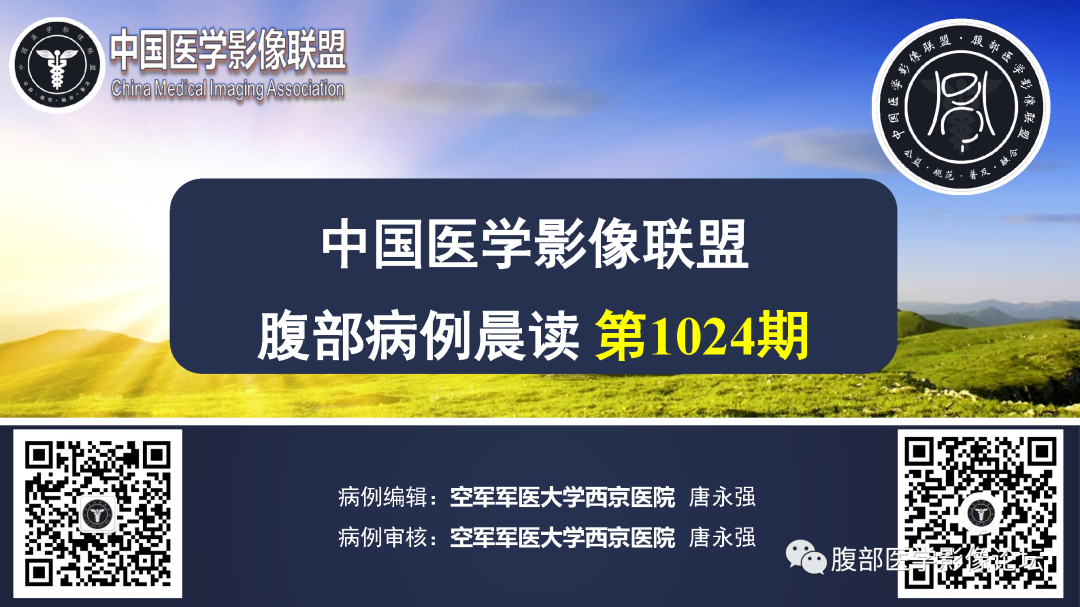 影像PPT - 【病例】中肠旋转不良1例CT影像-1