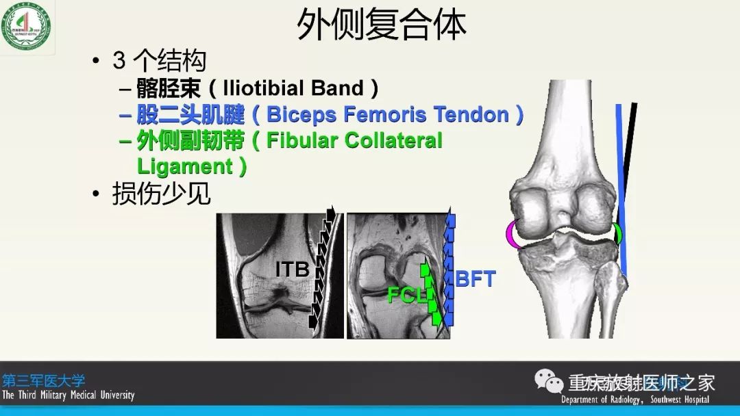 影像PPT - 【PPT】膝关节韧带MRI诊断要点-17