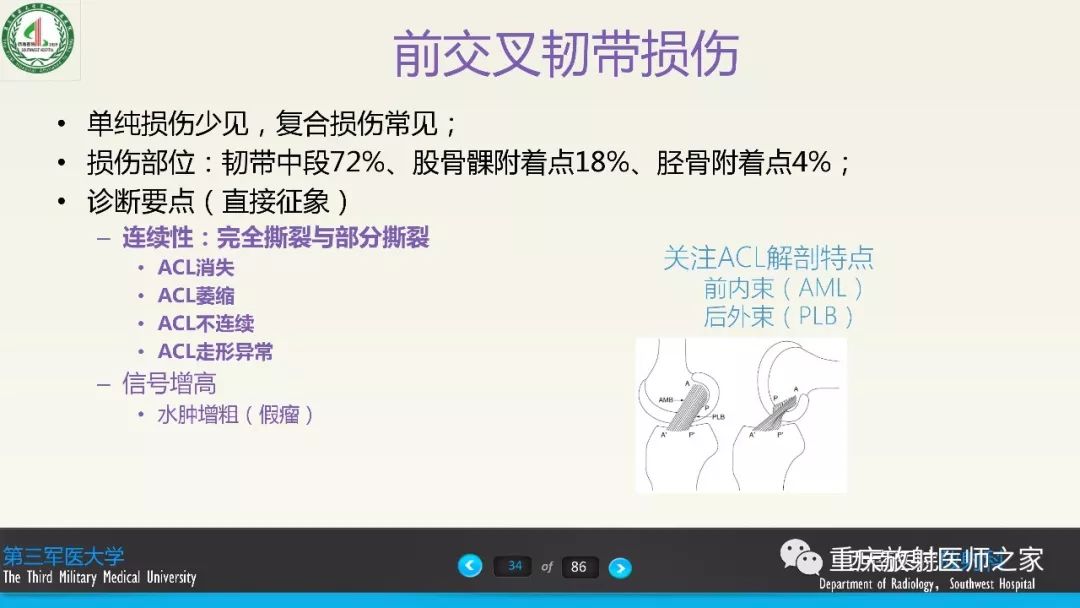 影像PPT - 【PPT】膝关节韧带MRI诊断要点-34