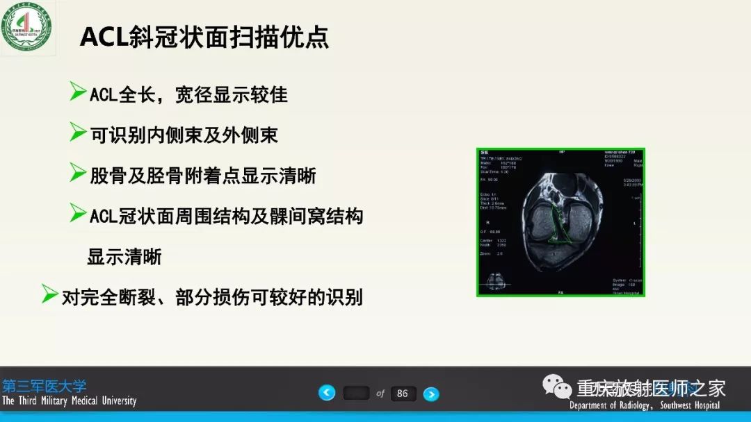 影像PPT - 【PPT】膝关节韧带MRI诊断要点-63