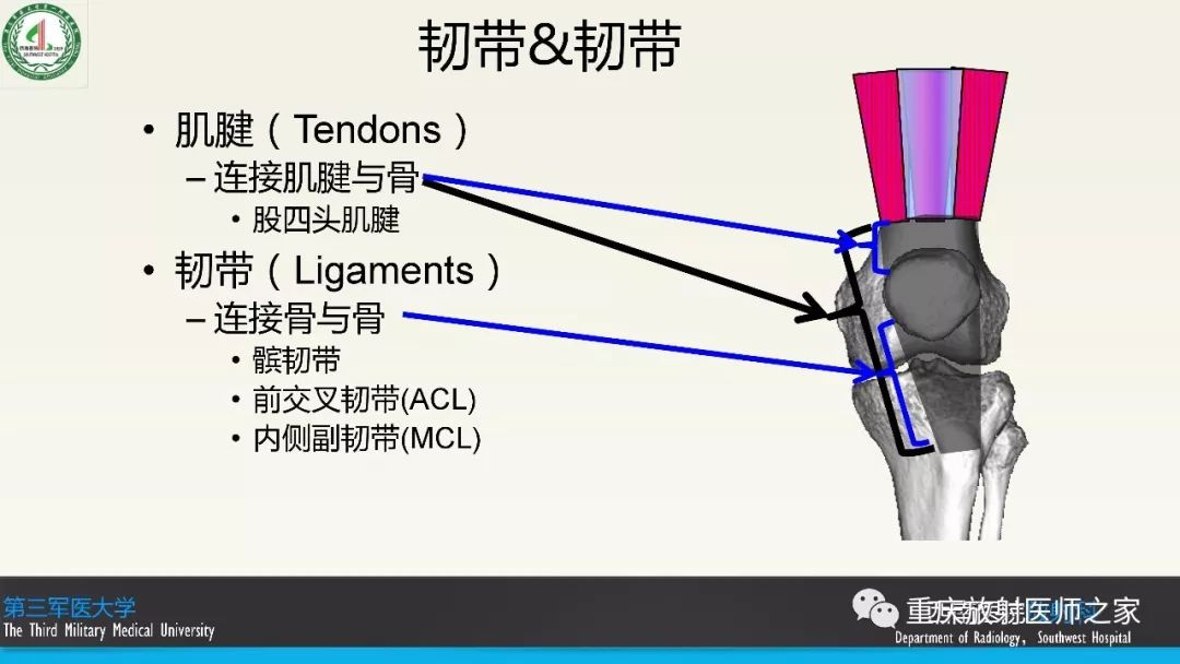 影像PPT - 【PPT】膝关节韧带MRI诊断要点-2