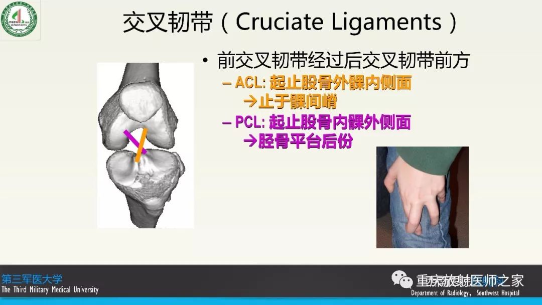 影像PPT - 【PPT】膝关节韧带MRI诊断要点-4