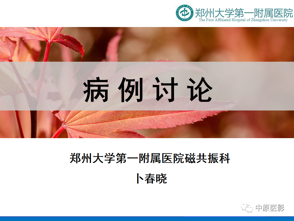 影像PPT - 【病例】脊柱胸椎腱鞘巨细胞瘤1例CT及MR-1