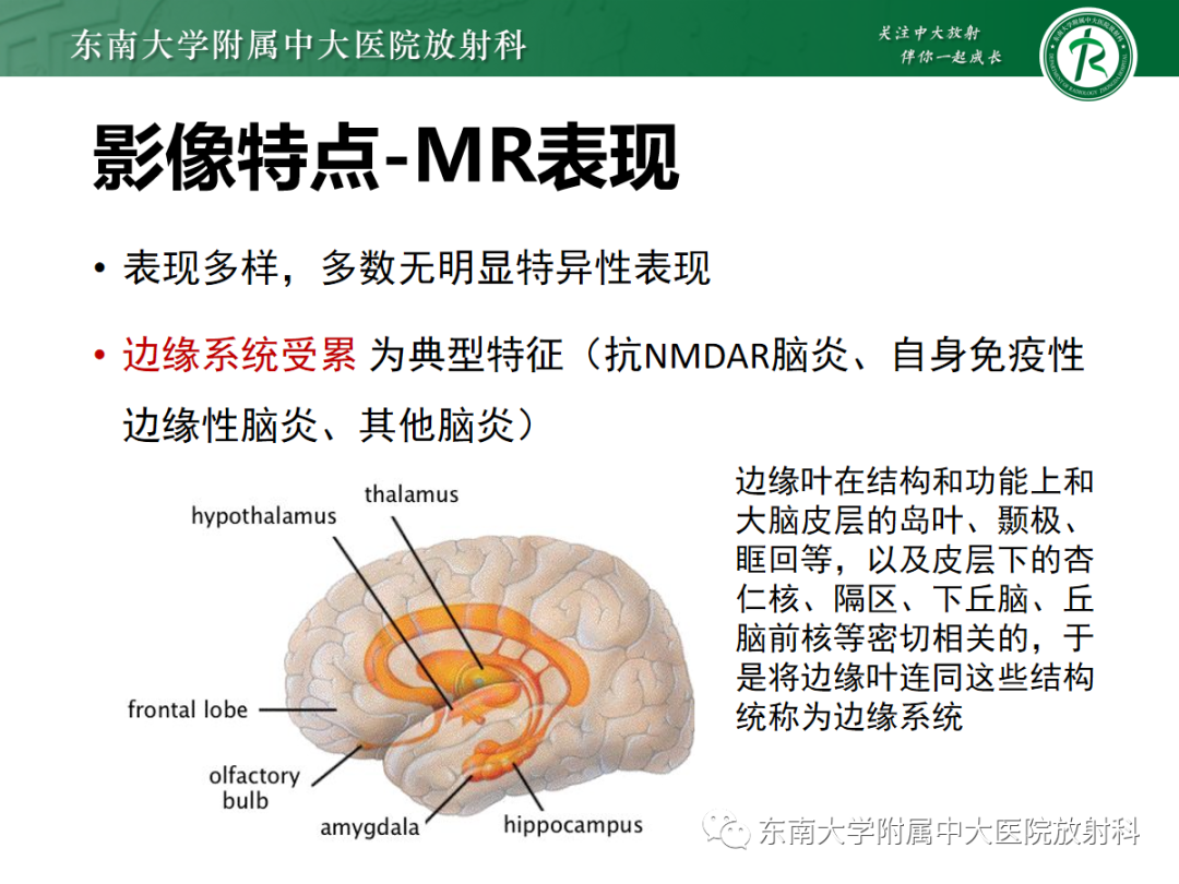 影像PPT - 【PPT】自身免疫性脑炎-11