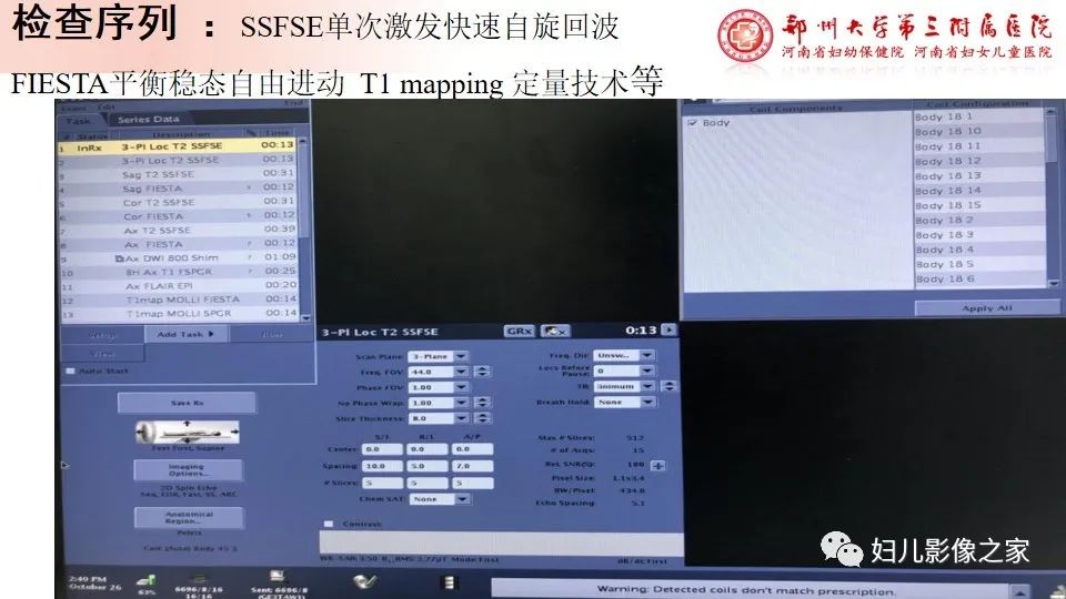 影像PPT - 【PPT】胎儿脉管畸形的影像诊断-8