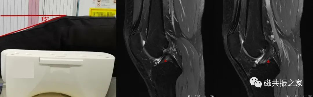 影像PPT - 那些简单又实用的MRI扫描体位-5 影像PPT - 那些简单又实用的MRI扫描体位-5