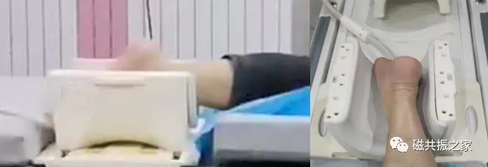 影像PPT - 那些简单又实用的MRI扫描体位-11 影像PPT - 那些简单又实用的MRI扫描体位-11